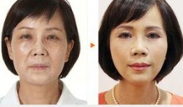 新疆整形爆料案件最新进展,真相逐步浮出水面