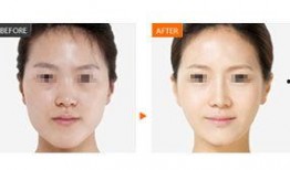 新疆整形爆料案件最新进展,真相逐步浮出水面